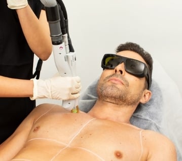 Laser Skin Treatment in Huntingdon Valley PA Laser Treatment